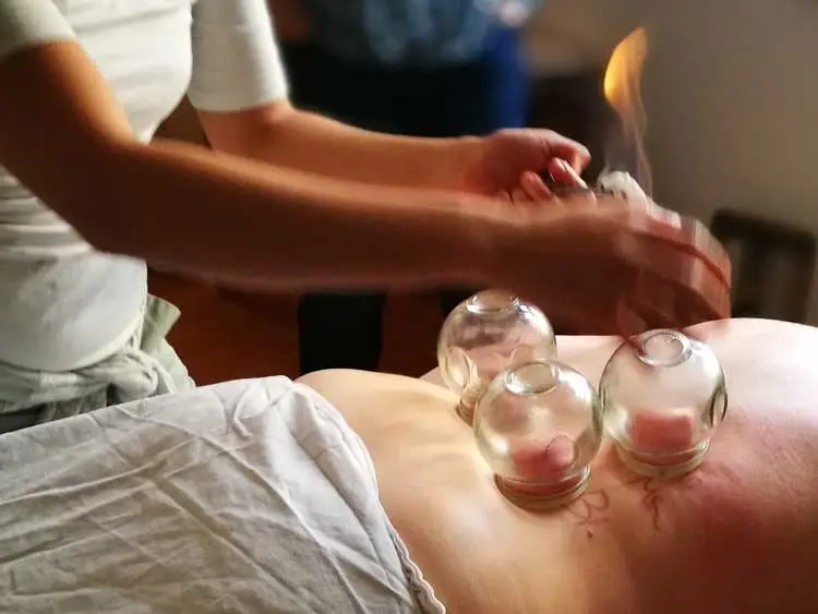 Tuina Paxis Workshop Schroepfen Nov `17